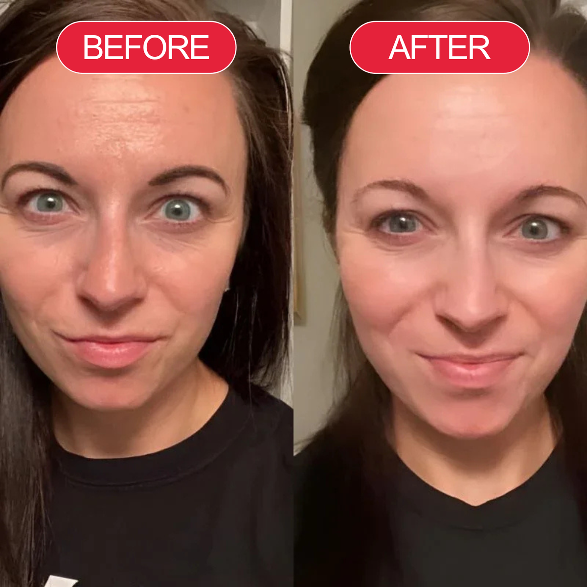 Before and after
