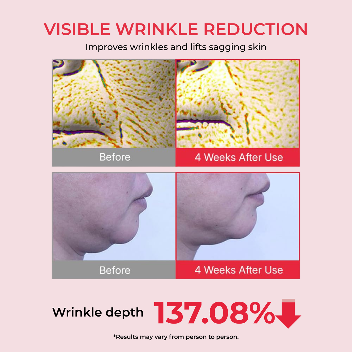 Visible wrinkle reduction: wrinkle depth 137.08% after 4 weeks