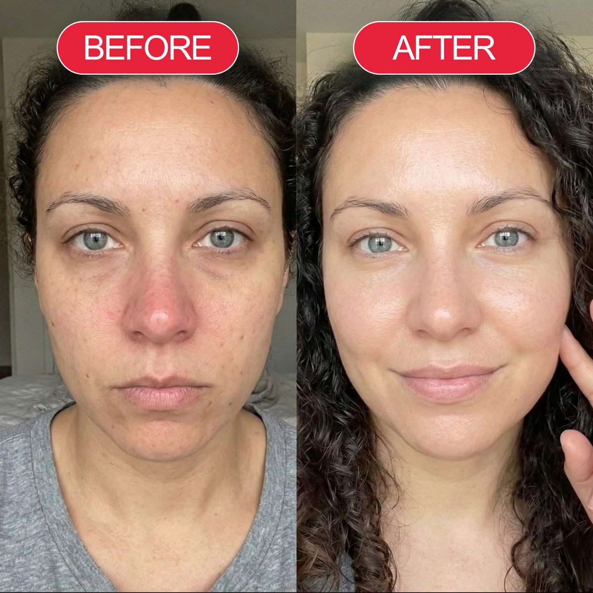 Before and after